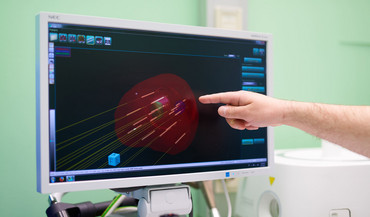 Männerarm zeigt auf einen Monitor, auf dem eine Bestrahlung dargestellt wird.